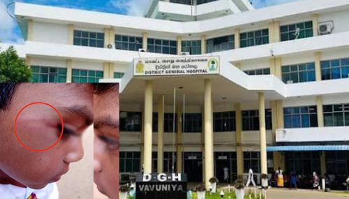 வவுனியாவில் ஆசிரியரின் தாக்குதலுக்குள்ளான மாணவன் வைத்தியசாலையில் அனுமதி