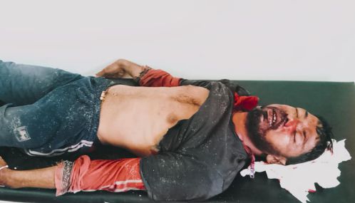 சுண்டிக்குளத்தில்  கரைவலை மீன்பிடியில் ஈடுபட்டுக்கொண்டிருந்த  இளைஞனின் படகு விபத்தில் சிக்கி உயிரிழப்பு!