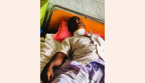 மன்னார் தாழ்வுபாடு கடலில் இரு படகுகள் மோதி விபத்துக்குளளானதில் ஒருவர் காயம்