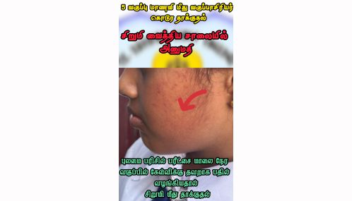 மன்னாரில் பெண்கள் பாடசாலை ஒன்றின் 5 ஆம் வகுப்பு மாணவியை அவரது ஆசிரியை கொடூரமாக அறைந்த நிலையில்  சிறுமி வைத்தியசாலையில் அனுமதி!